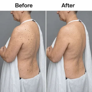 The nkey Glycolic Body Stick